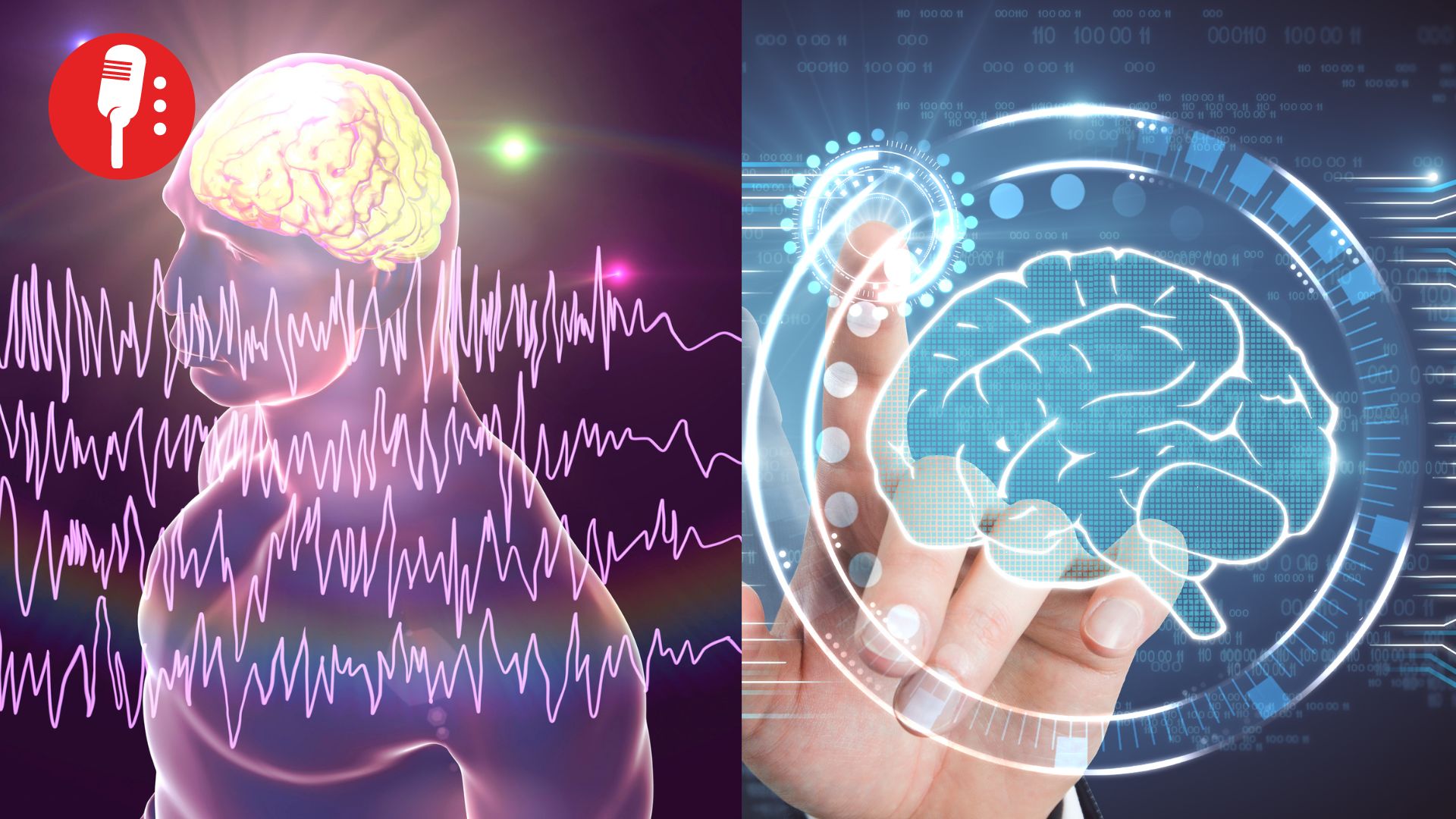Inteligencia Artificial detecta malformaciones cerebrales ocultas en niños con epilepsia